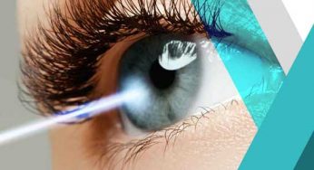4 Myths About LASIK You Should Stop Believing