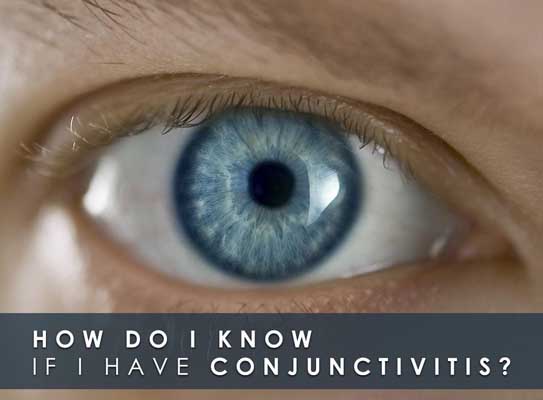 How Do I Know If I Have Conjunctivitis?