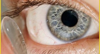 Important Tips for Preventing Contact Lens Infections