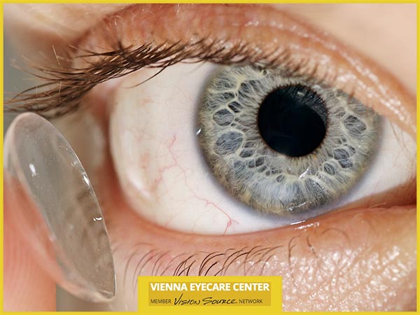 Important Tips for Preventing Contact Lens Infections