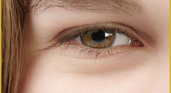 What You Should Know About Blocked Tear Ducts