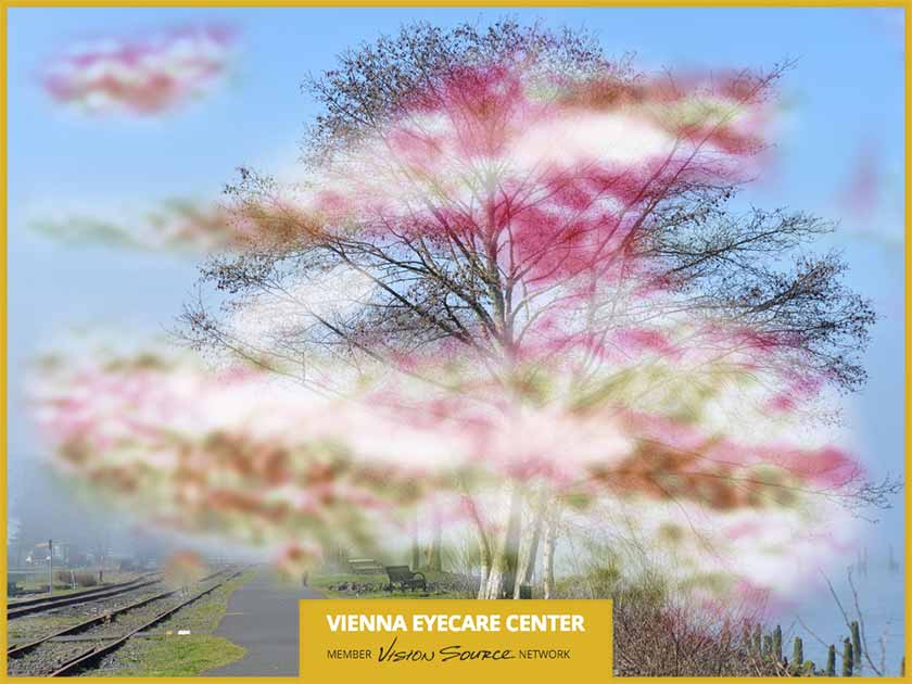 What’s the Difference Between Ocular and Visual Migraines?
