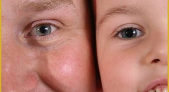 Can You Inherit Eye and Vision Problems?