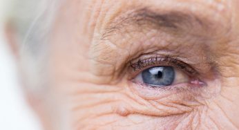 How Optometrists Manage Age-Related Macular Degeneration